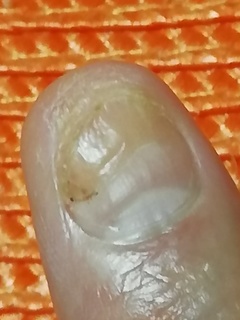 IMG_20191103_201350.jpg